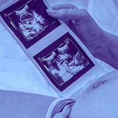 mother holding ultrasound photo on belly